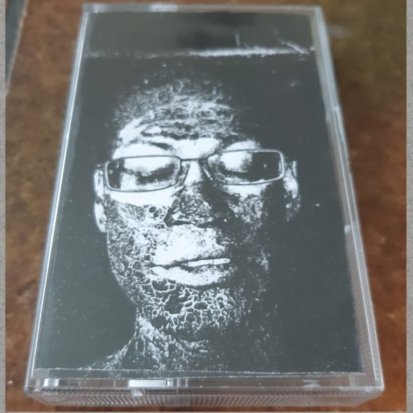 Anomaly - Jeroen Elswijk (shit slave) *